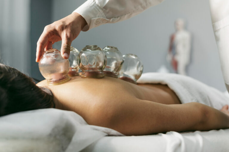 Cupping Therapy: Ancient Healing Meets Modern Wellness